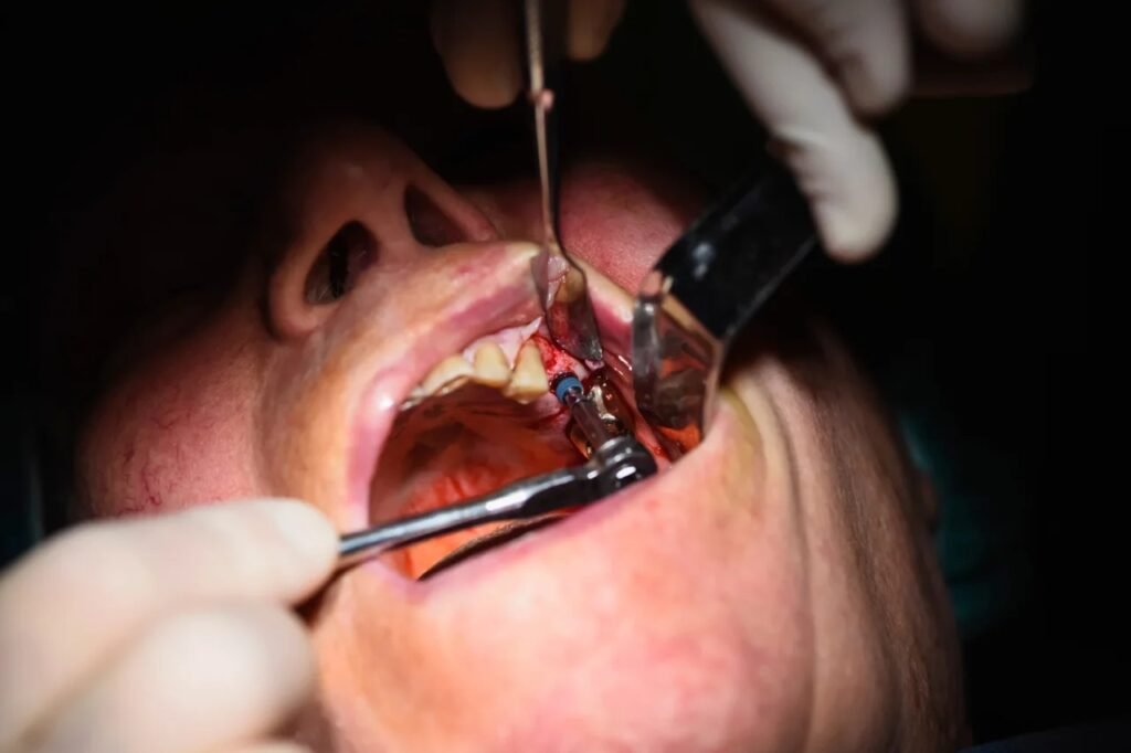 Raymore Family Dentistry|Oral Surgery