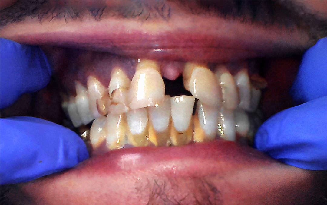Raymore Family Dentistry | Before & After Photos
