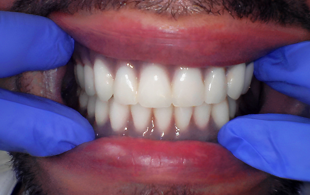 Raymore Family Dentistry | Before & After Photos